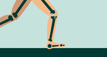 Hoegaathetmetuwknieprothese 1