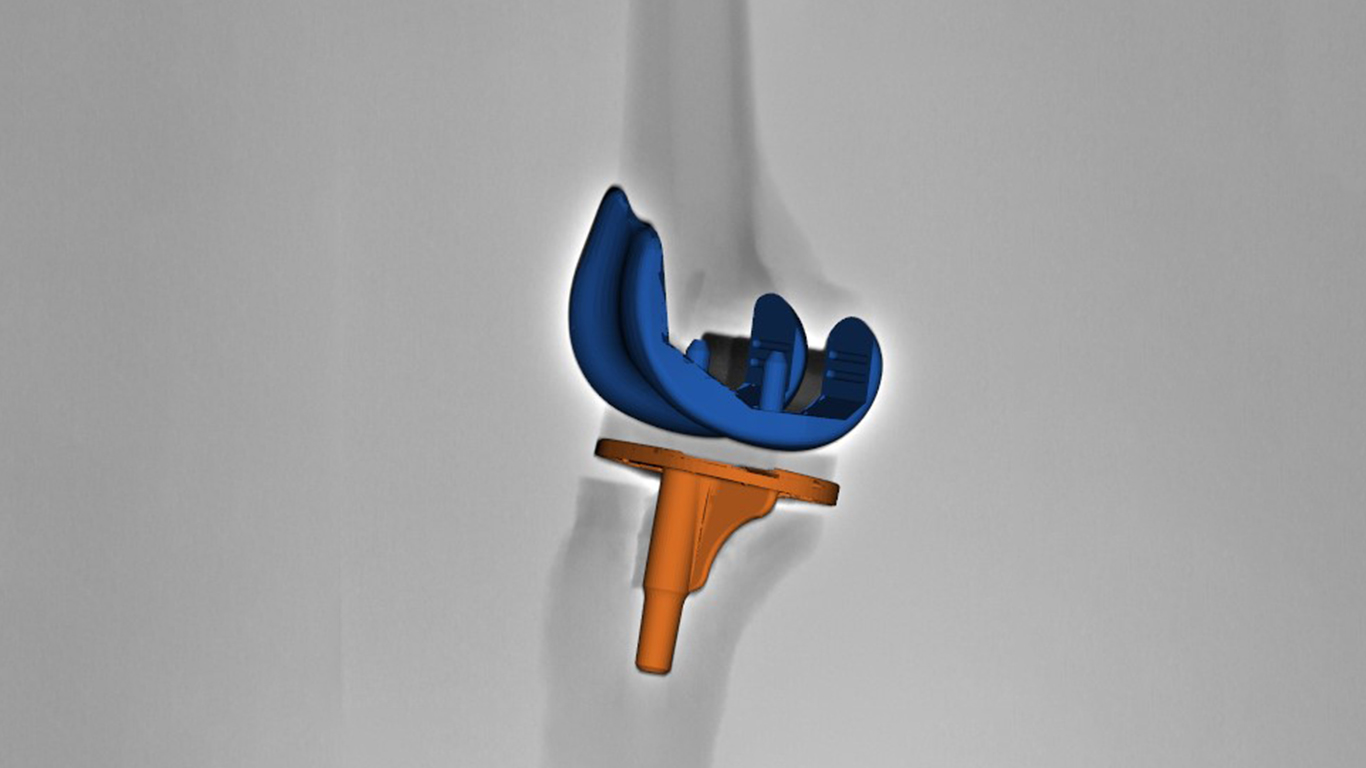 Kwalificatie Knie Groot